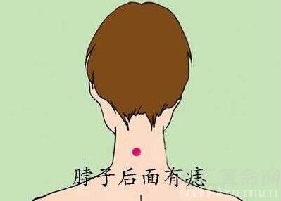 身上最好的16痣相部位 你有吗（印堂痣男贵女富）