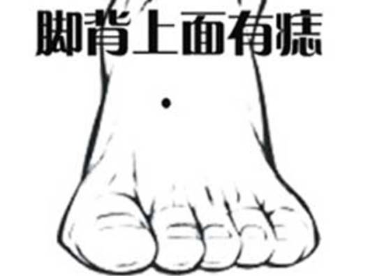 男人脚背长痣代表什么，代表奔波劳碌，招小人