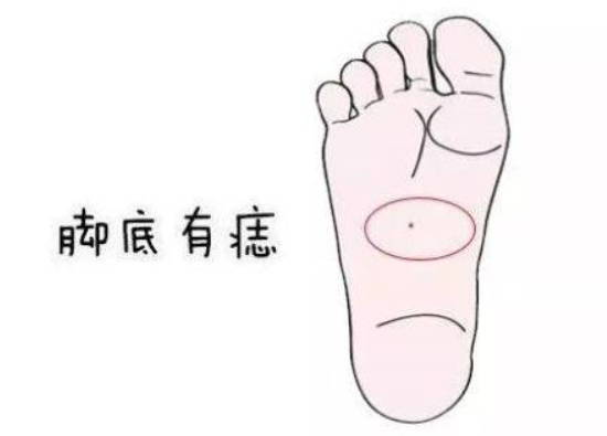 ​​​​​​​脚心长痣有什么含义，代表贵气，运势好